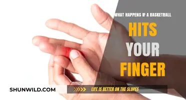 Basketball Finger Injury: What Happens When the Ball Hits Your Digit?