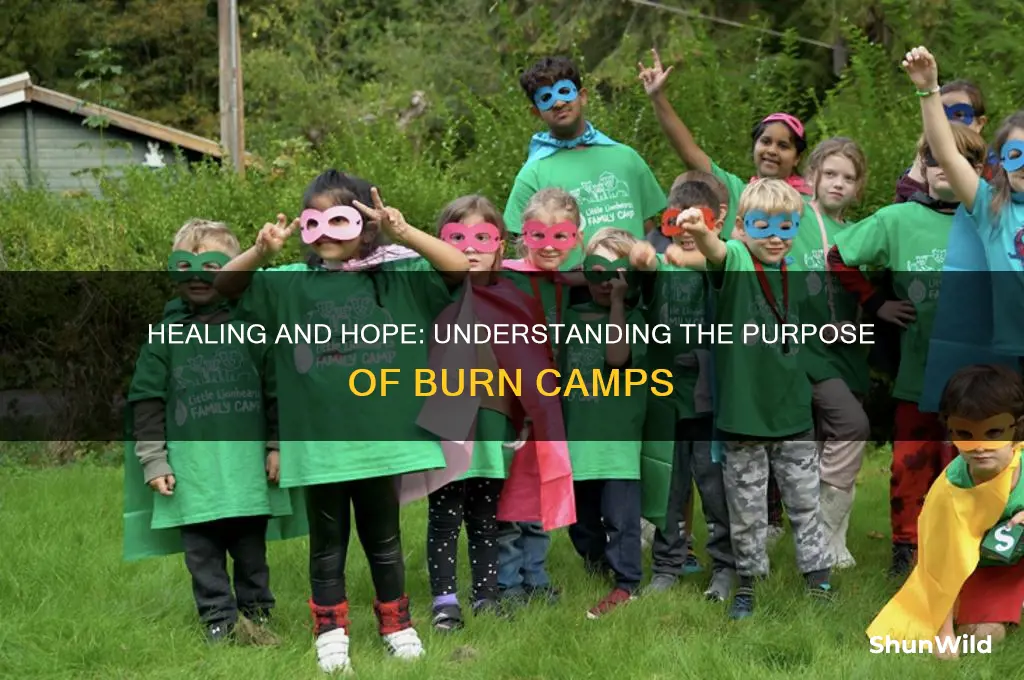 what is a burn camp