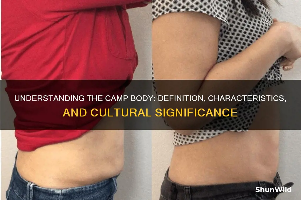 what is a camp body