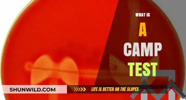 Understanding the Camp Test: Purpose, Procedure, and Practical Applications