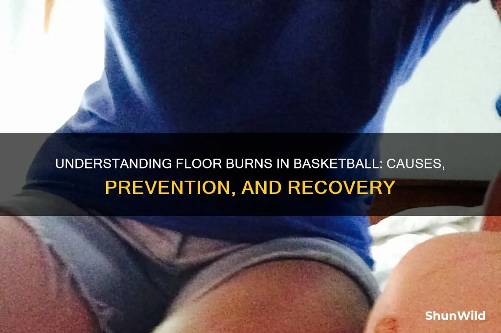 what is a floor burn in basketball