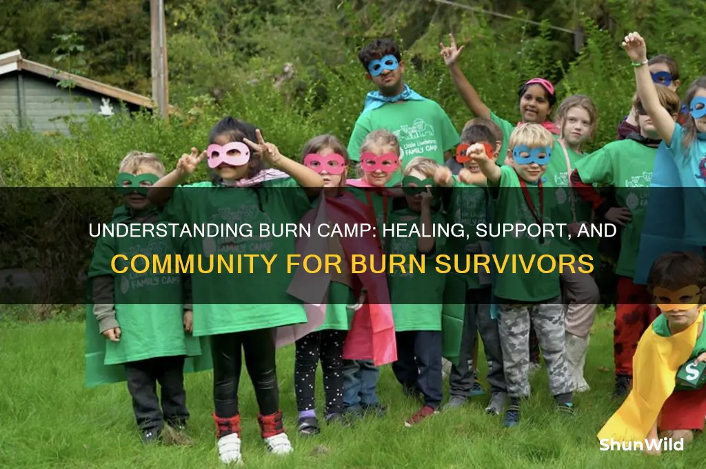 what is burn camp