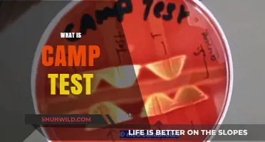 Understanding the Camp Test: A Comprehensive Guide to Its Purpose and Use