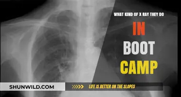 Boot Camp X-Ray Procedures: What to Expect During Military Training