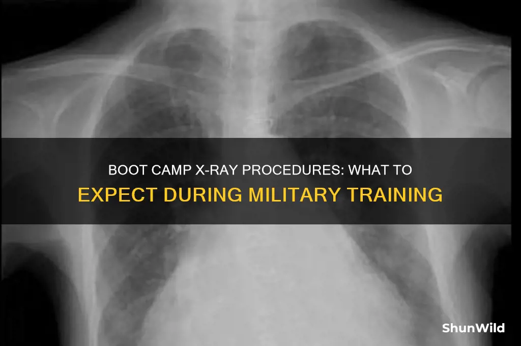 what kind of x ray they do in boot camp