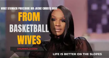 Jackie Christie's Surprising Stomach Procedure Explained