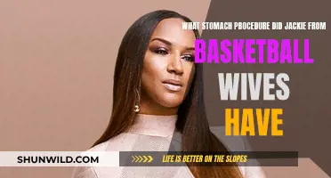 Jackie's Basketball Wives Weight Loss Surgery Secrets
