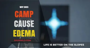 Unraveling the Mystery: Why Camp Can Cause Edema