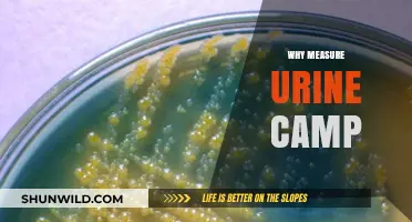 Decoding the Importance of Urine Camp Measurements in Health Assessments