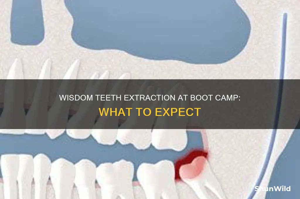 will they pull my wisdom teeth at boot camp